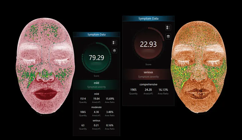Advanced AI Skin Analyser