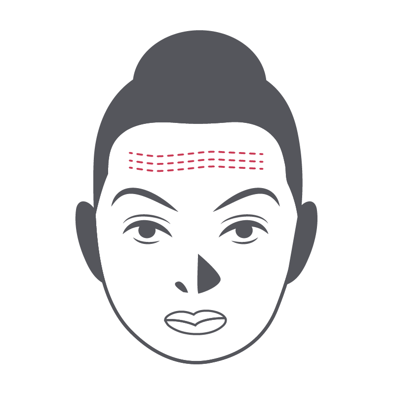 Forehead Lines