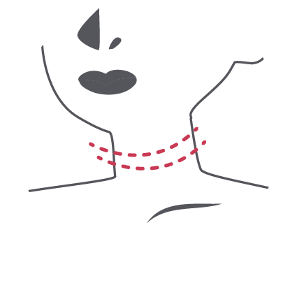 Neck Lift