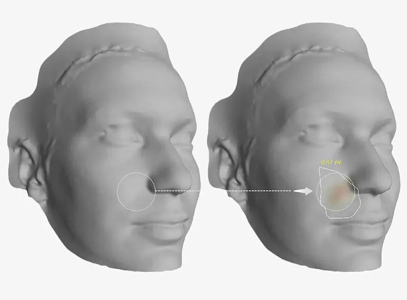 VCare 3D Imaging System
