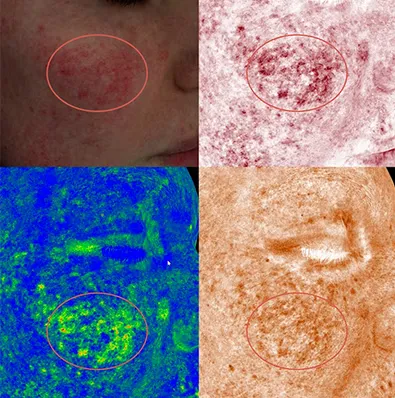 In Built Treatment Simulator