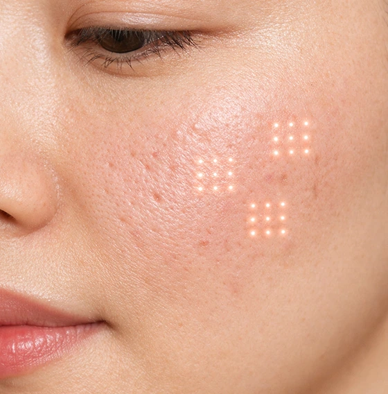 Korean Glass Skin Facial Treatment