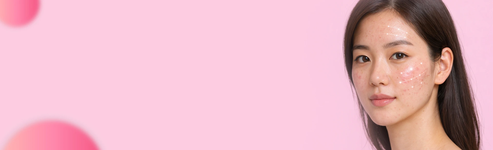 Types of laser treatment